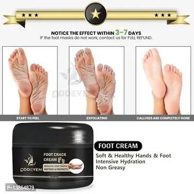 Foot Care Cream For Rough, Dry And Cracked Heel (50Gm) For Woman.