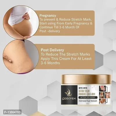 Stretch Marks Scar Removal Cream Cream During After Pregnancy Delivery Women Organic Bio Cream For To Remove Hyperpigmentation,Anti Cellulite-thumb3