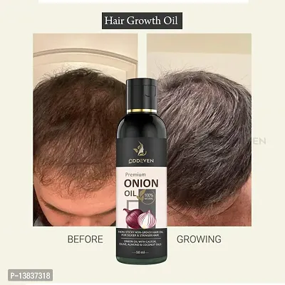 Onion Black Seed Hair Oil Onion Hair Oil (50Ml) (Pack Of 1)