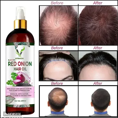 Onion Oil For Hair Regrowth Hair Oil And Red Onion - 200 Ml