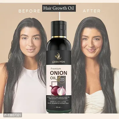 Pure And Natural Onion Herbal Hair Oil For Anti Hair Fall | Onion Hair Oil (50Ml) (Pack Of 1)| Pack Of 1