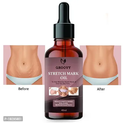 Advance Repair Stretch Marks Removal - Natural Heal Pregnancy Breast, Hip, Legs, Mark Oil - 40 Ml