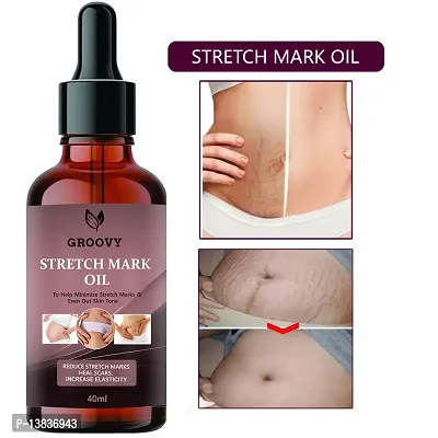 Stretch Marks Oil To Reduce Stretch Marks Of Body, Belly, Thighs, Uneven Skin Tone, Firming, Nourishment For Woman  40 Ml-thumb0