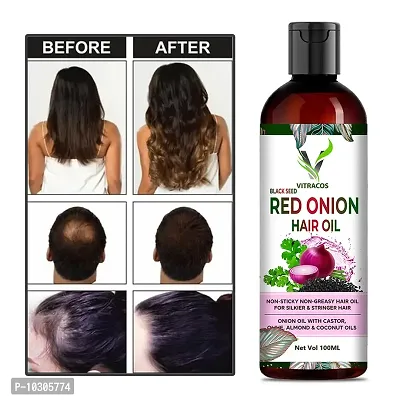 Onion Oil - Reduces Hair Fall, 100 ml &hellip; Hair Oil- 100 Ml