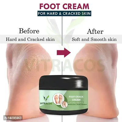 Foot Care Cream For Rough, Dry And Cracked Heel 50 Grams For Men And Women