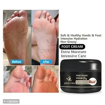 Foot Cream Looking Nutri Height Capsules Darar For Cracked Heels Antiseptic Cream.