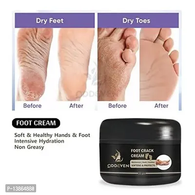 Foot Crack Cream For Dry Cracked Heels  And Softening Cream (50Gm)