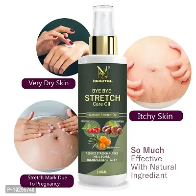 Nainital Stretch Marks Oil After Delivery Effective And No Chemical 100Ml