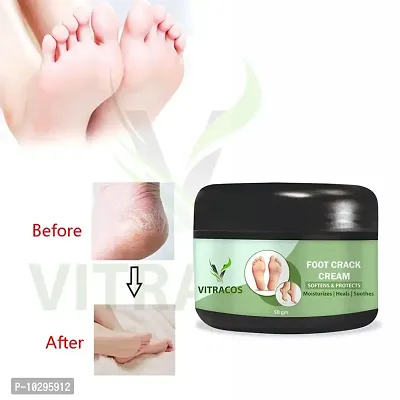 Foot Crack Cream For Men 50 Grams