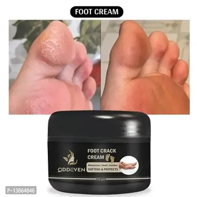 Foot Crack Cream