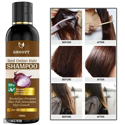 nbsp;Onion Shampoo For Hair Regrowth Hair Shampoo And Red Onion 100 Ml