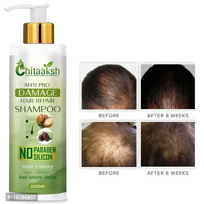 Anti Hair Fall Shampoo - For Normal - Oily Hair 200Ml