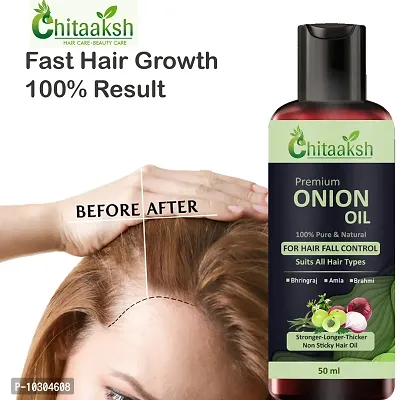 Onion Hair Oil With Black Seed Oil - Controls Hair Fall - No Mineral Oil, Silicones And Synthetic Fragrance 50 For Man And Women-thumb0