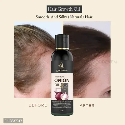 Ayurvedic Onion With Black Seed Oil For Controls Hair Fall Hair Oil Onion Hair Oil (50Ml) (Pack Of 1) (Pack Of 1)