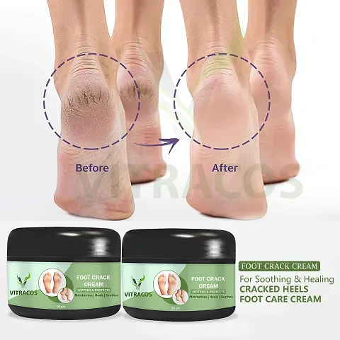 Top Quality Foot Cream Combo