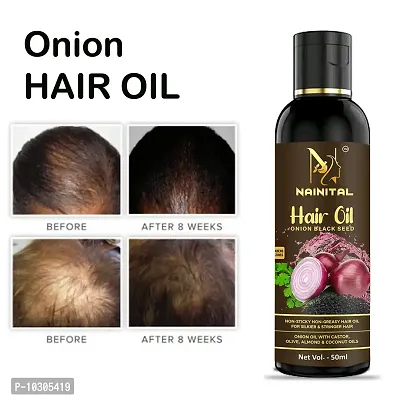 Onion Oil Black Seed Hair Oil 50Ml For Man And Women