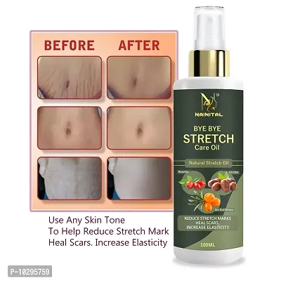 Nainital Safe Organic Stretch Mark Oil 100 Ml-thumb0