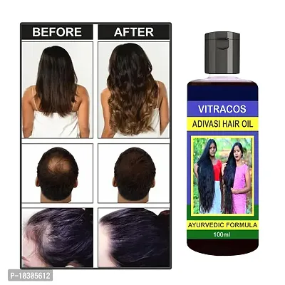 Advanced Hair Oil-Hair Growth Oil- 100 Ml-thumb0