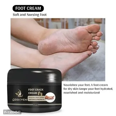 Feet Need To Special Care For Crack Cream -50 Gm