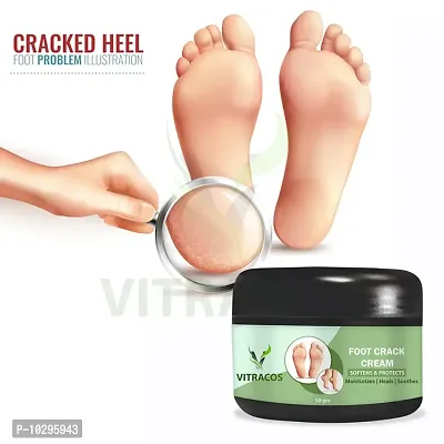 Foot Crack Cream 50 Grams For Man