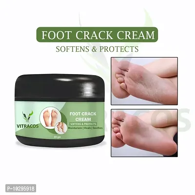 Foot Care Cream For Rough, Dry And Cracked Heel Feet Cream For Heel Repair Healing And Softening Cream 50 Grams