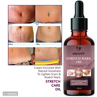 Stretch Mark Oil With The Goodness Of Seabuckthorn Oil, Vitamin E And C, Lavender | All Skin Types | For Scars And Stretch Marks-40Ml-thumb0