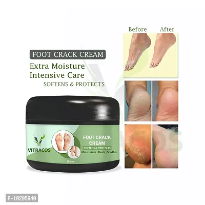 Foot Crack Cream 50 Gramshealing And Softening Cream For Man And Women