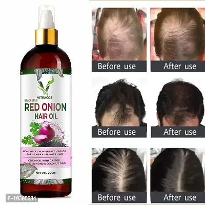 Organique Red Onion Hair Oil With Keratin Protein Booster, Nourishes Hair Follicles, Anti - Hair Loss, Regrowth Hair Oil 200 Ml