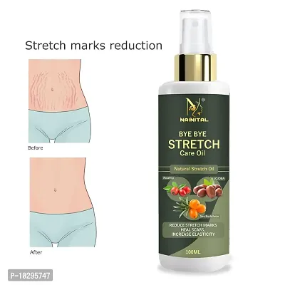 Nainital After Delivery Stretch Mark Removal Oil 100Ml-thumb0