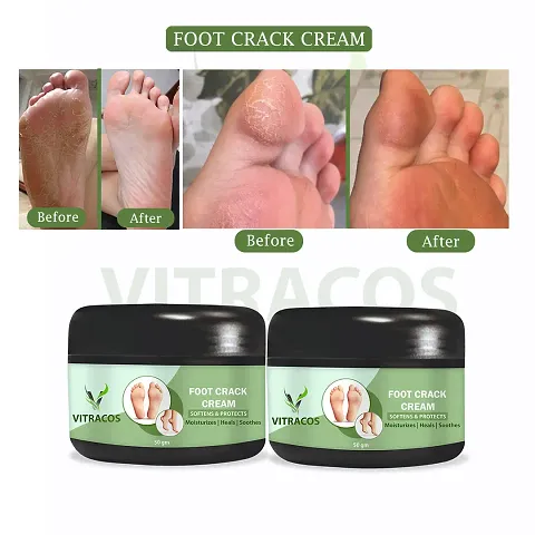 Best Foot care Foot Crack Cream