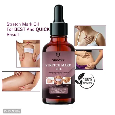 Advance Natural Stretch Oil For Scars And Stretchmarks (40 Ml)-thumb0