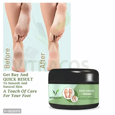 Foot Cream Looking Nutri Height Capsules Darar For Cracked Heels Antiseptic Cream 50 Grams