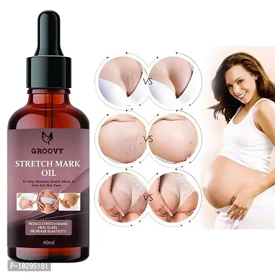 Stretch Marks Oil Stretch Mark Oil For Women And Men - Scars, Uneven Skin Tone And Spots Removal Oil 40 Ml-thumb0