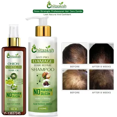 Anti Hairfall Shampoo With Oil - For Normal - Oily Hair (200Ml With 100Ml)