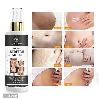 Natural Stretch Oil With Coconut, Olive And Jojoba Oils, For Scars And Stretchmarks  (100 Ml)