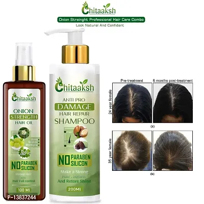 Anti Hairfall Bhringraj Shampoo With Oilnbsp; (200Ml With 100Ml)