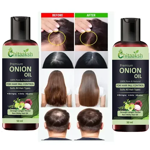 Chitaaksh Onion Hair Oil