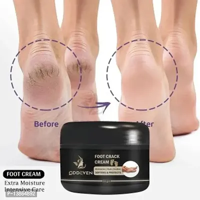 Foot Cream Cracks Away Cream (50Gm) For Man And Woman.