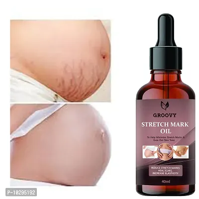 Stretch Marks Oil Soothing Scar And Stretch Mark Removal Oil Pregnancy And Postpartum Safe All-Natural, Paraben-Free 40 Ml