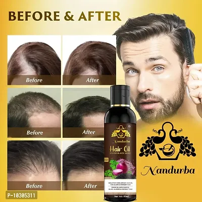 Onion Oil New Hair Growth And Hair Fall Solution 50Ml