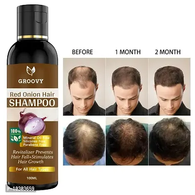 Onion Hair Shampoo For Long Hair, Hair Growth Women And Men Hair Shampoo 100 Ml-thumb0