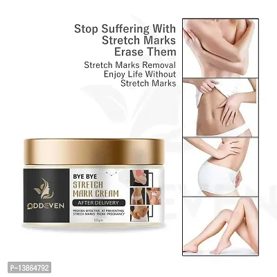 Stretch Marks Cream Best Result In Just 7 Days