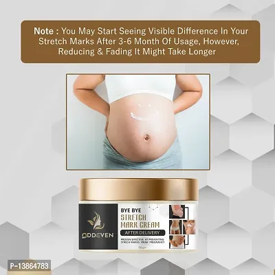 Stretch Marks Scar Removal Cream Cream During After Pregnancy Delivery Women Organic Bio Cream For To Remove Hyperpigmentation,Anti Cellulite-thumb4