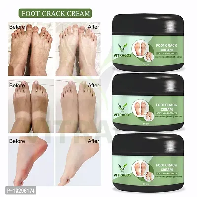 Foot Care Cream For Rough, Dry And Cracked Heel Feet Cream For Heel Repair Healing And Softening Cream - 50 Grams Each, Pack Of 3-thumb0