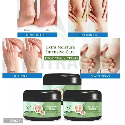 Pedicure And Manicure Citrus Hand And Foot Cream Masque - - 50 Grams Each, Pack Of 3 Foot Care Crack Cream - 50 Grams