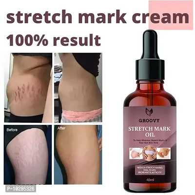 Stretch Marks Oil After Delivery Stretch Mark Removal Oil 40Ml-thumb0