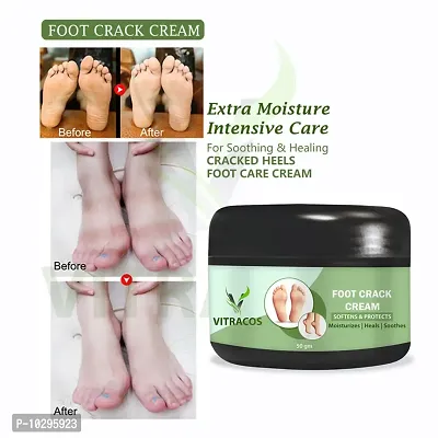 Foot Crack Cream For Dry Cracked Heels And Feet, 50 Gms