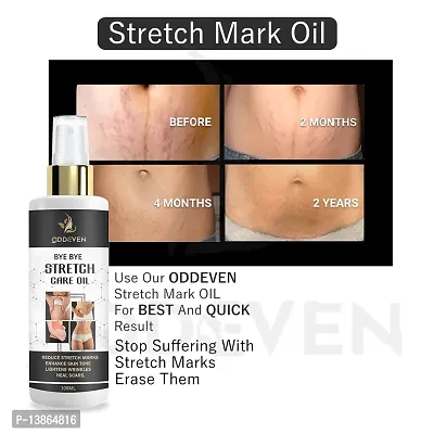 Present Stretch Marks Removal Oil - Natural Heal Pregnancy, , Legs, Mark Oil 100 Ml Pack Of 1