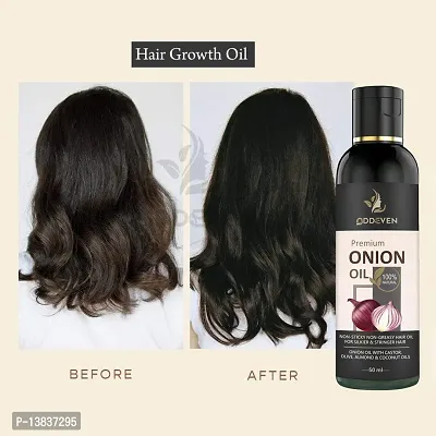 Red Onion Hair Fall Control* Hair Oil Onion Hair Oil (50Ml) (Pack Of 1)