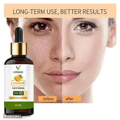 Vitracos Skin Illuminate Vitamin C Serum For Radiant Skin With High Potency Vitamin C Turmeric - 45 Ml